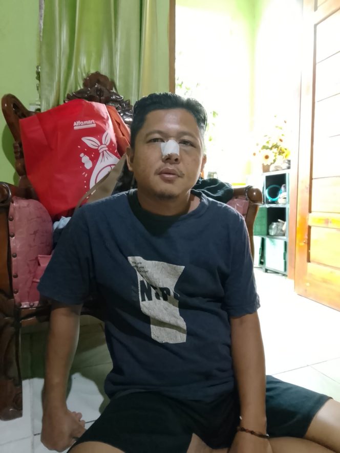 
 Belum Penuhi Dua Alat Bukti, Kasus Pengeroyokan Wartawan Lahat Berpotensi Dihentikan